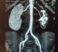Мультиспиральная компьютерная томография органов