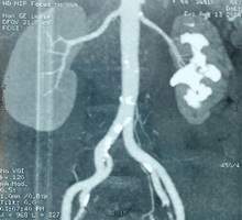 Мультиспиральная компьютерная томография органов с контрастированием