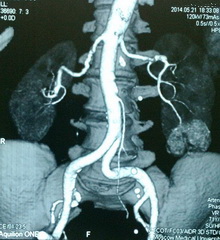 Мультиспиральная компьютерная томография органов
