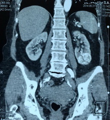 Мультиспиральная компьютерная томография
