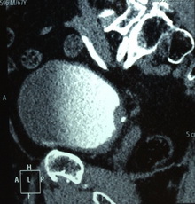 Мультиспиральная компьютерная томография