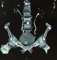 Мультиспиральная компьютерная томография органов
