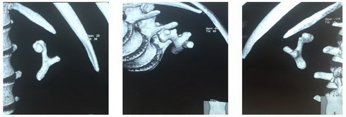 Мультиспиральная компьютерная томография