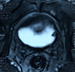 Магнитно резонансная томография