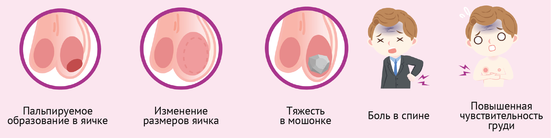 Симптомы рака яичек