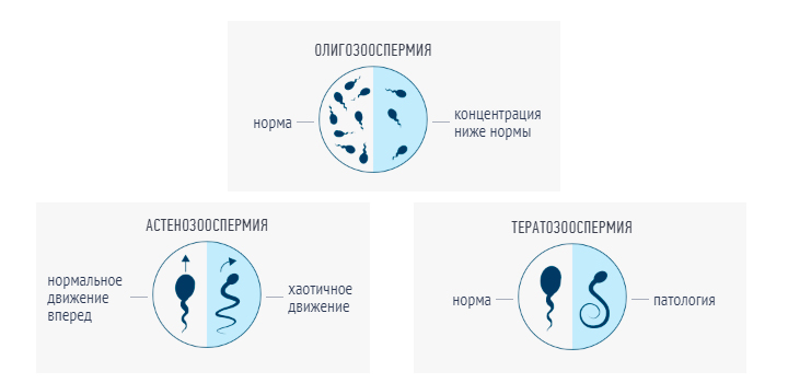 Несколько видов нарушения состава спермы