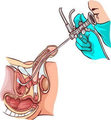 Забудьте о проблемах с простатой: ТУР простаты в профессиональной клинике